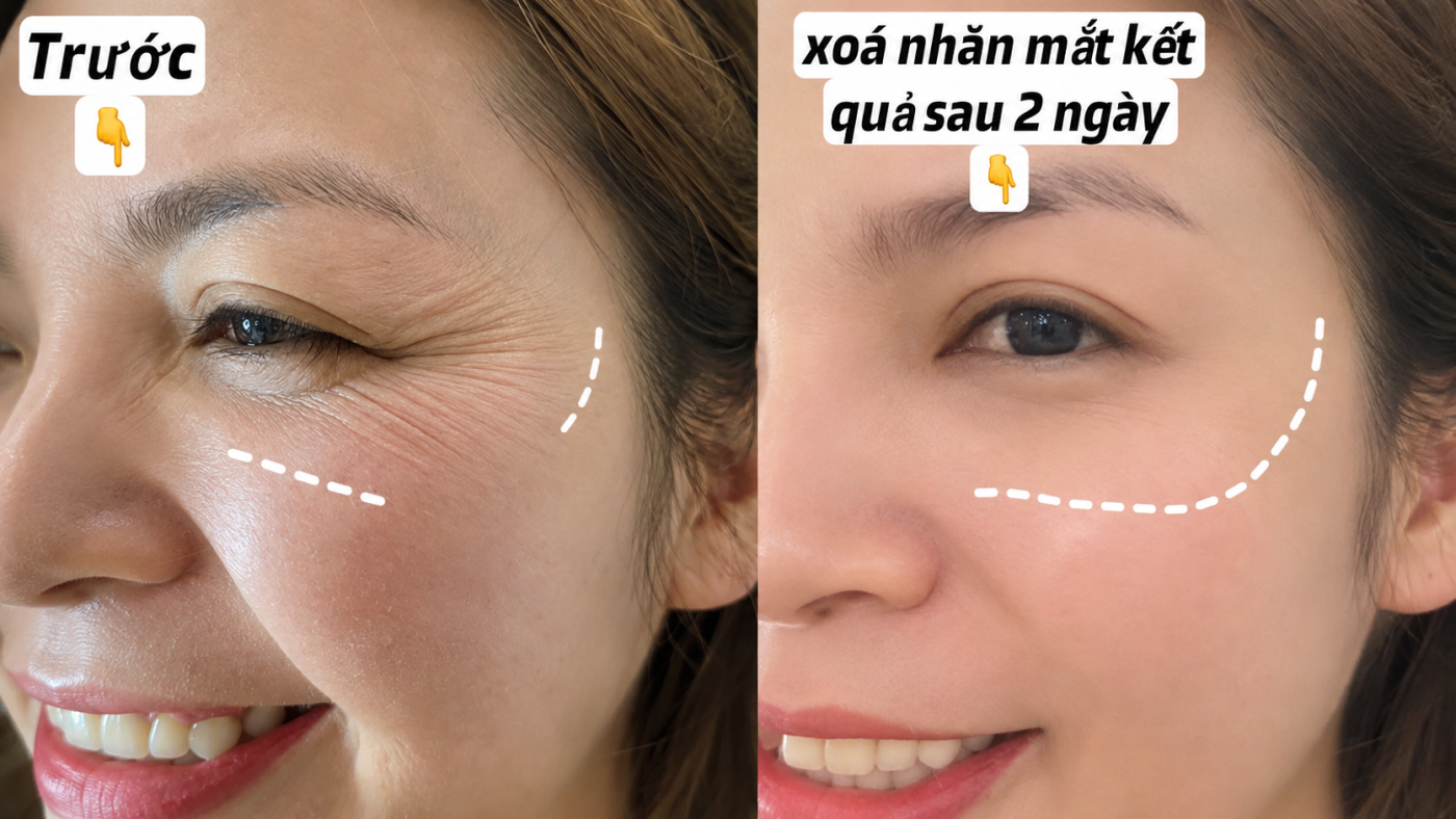 trẻ hóa da