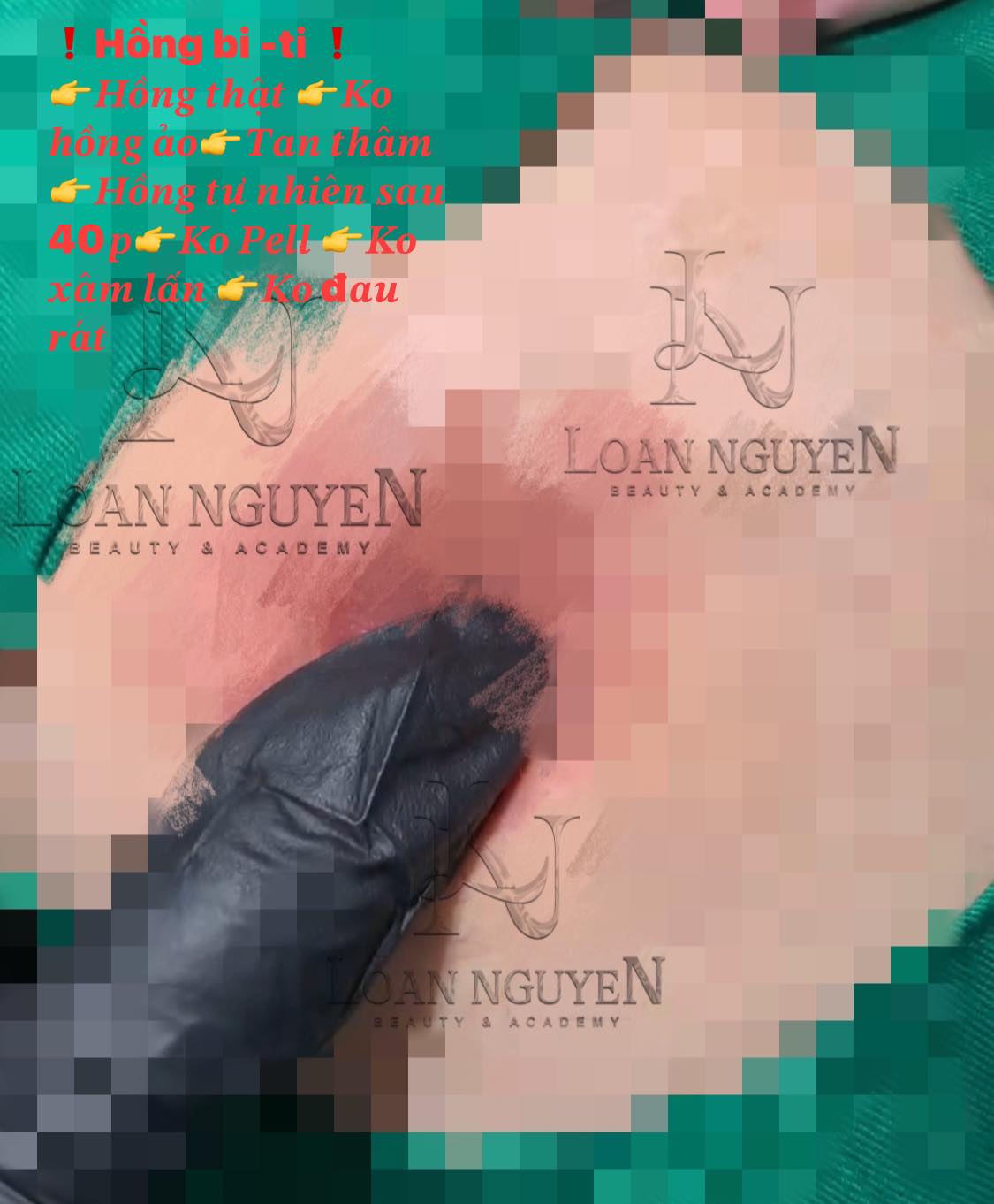 Làm hồng nhũ hoa, hồng bikini - Image 2