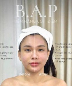 Bap nâng cơ trẻ hóa