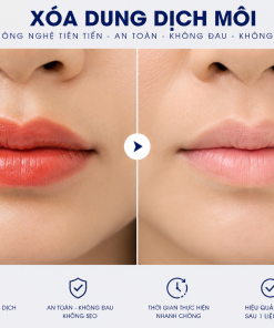 Xóa Dung Dịch Môi